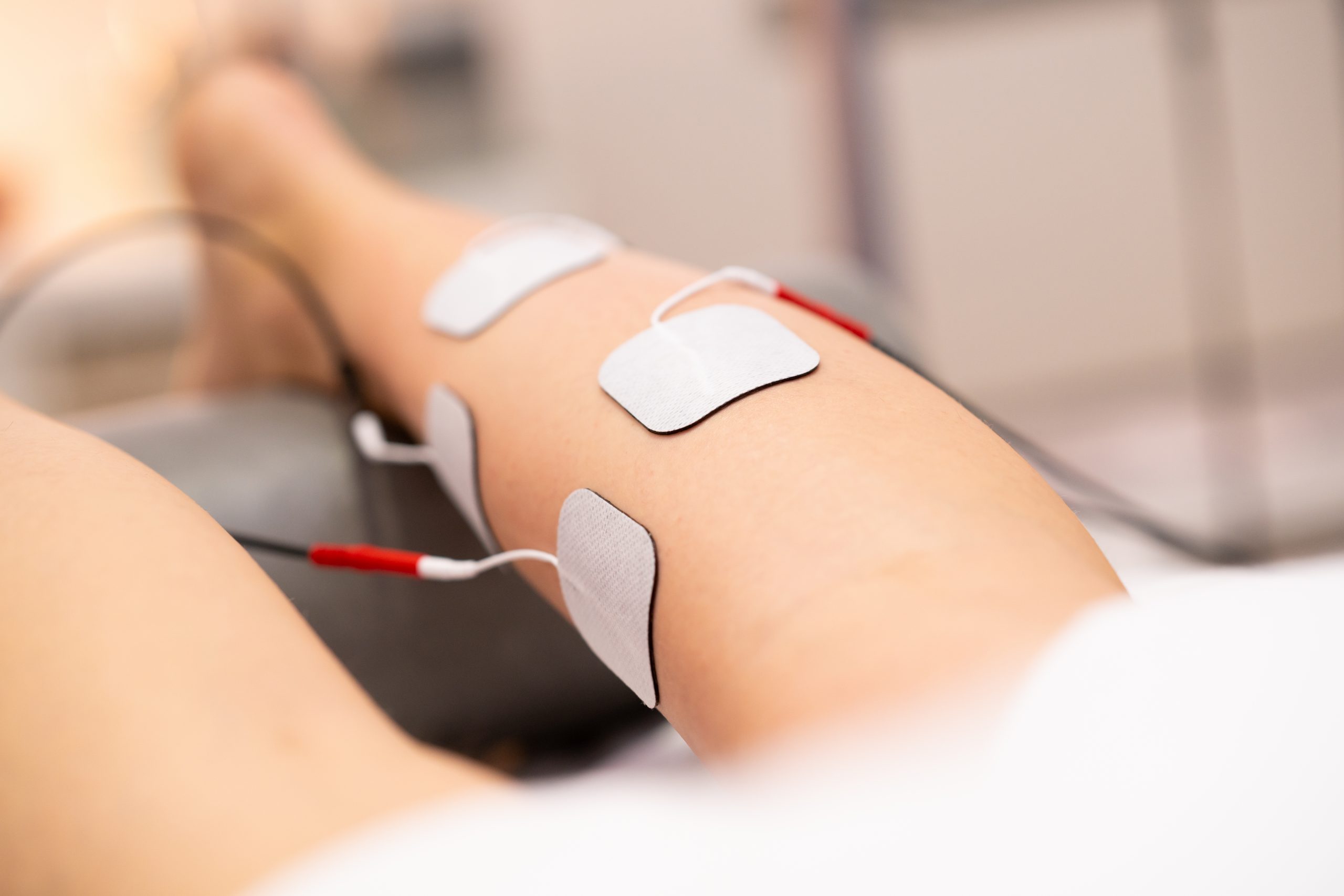 Elektrik Stimulasyon